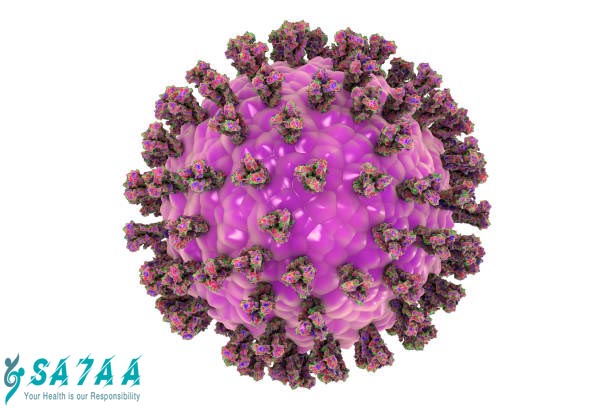 Measles
