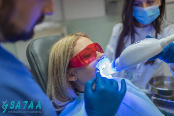 Teeth whitening