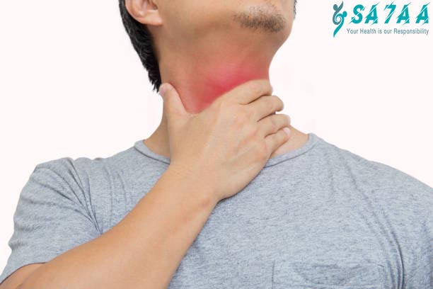 Goiter