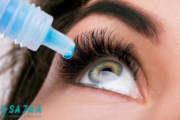 Eye allergy
