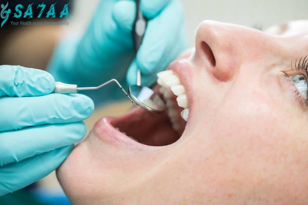 Teeth health